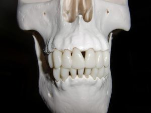 Doskonałe implanty zębowe które powinieneś posiadać